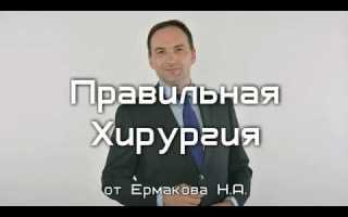 Пластика пупочной грыжи по мейо