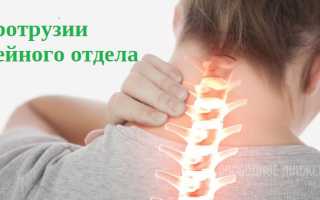 Грыжи дисков с3 с4 с5 с6