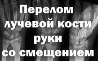 Как снять отек после перелома лучевой кости
