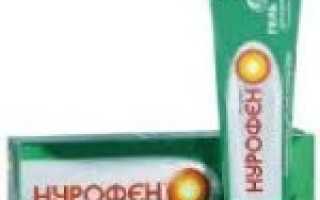 Кифотическая деформация шейного отдела позвоночника что это