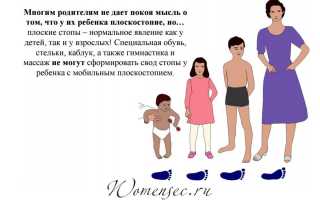 Плоскостопие у детей — как определить степень, симптомы и лечение