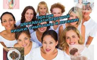Дивертикул двенадцатиперстной кишки: симптомы и лечение