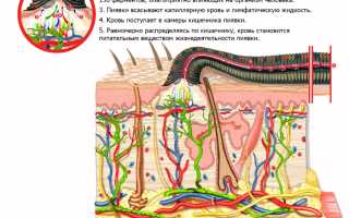 Гирудотерапия при артрозе и артрите коленного сустава