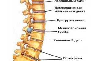 Немеет средний палец на правой руке причины
