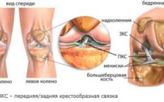 Отек костного мозга бедренной кости лечение