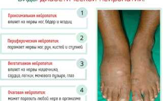 Лечение полинейропатии нижних конечностей лечебные препараты