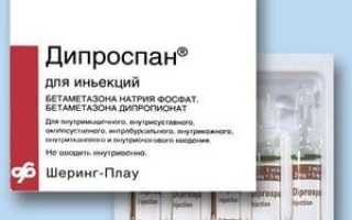 Дипроспан: инструкция по применению уколов и для чего он нужен, цена, отзывы, аналоги