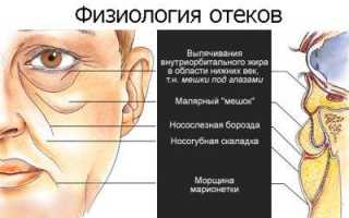 Появилась припухлость под глазом
