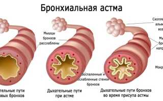 Нимесил: от чего помогает, инструкция по применению