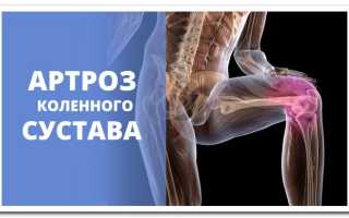 Препараты для блокады суставов — Суставы