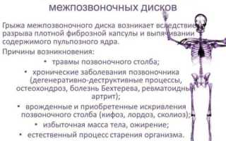 Главное о массаже при грыже поясничного отдела позвоночника. Узнать больше о Главное о массаже при грыже поясничного отдела позвоночника. Жмите.