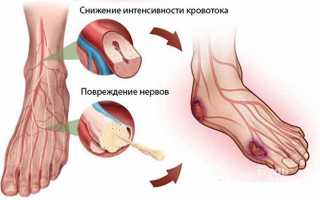 Единичные очаги глиоза лобных и теменных долей. Лечение глиозных очагов в мозге. Осложнения глиоза и его профилактика.