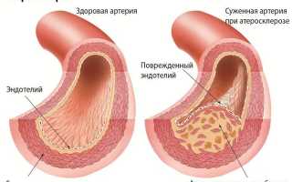 Ноют ноги ниже колен причины чем лечить