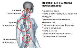 Сосудорасширяющие препараты при остеохондрозе шеи: лучшие средства