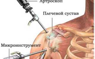 Миалгия и артралгия — Суставы