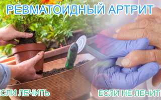 Протокол лечения ревматоидного артрита казахстан —