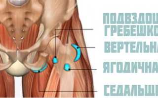 Вертельный бурсит тазобедренного сустава — Суставы