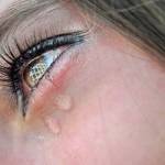 слезятся глаза при гриппе