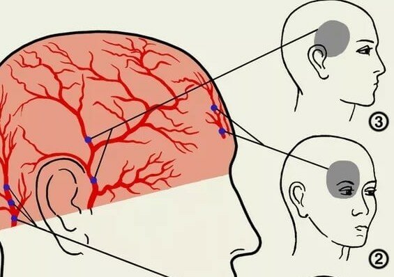 Закрываешь глаз болит голова