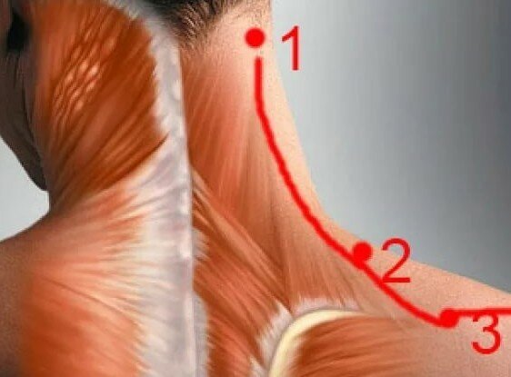 если болит шея сзади и голова к какому врачу обратиться