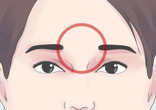 почему болит лоб и давит виски