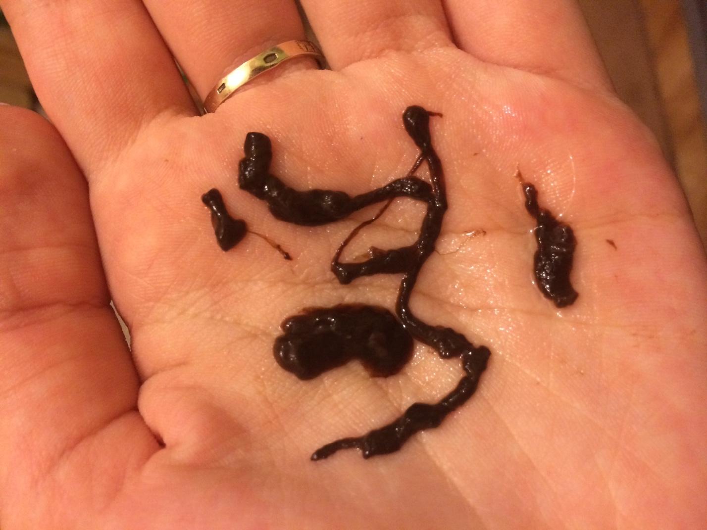 Мажущие выделения в середине цикла