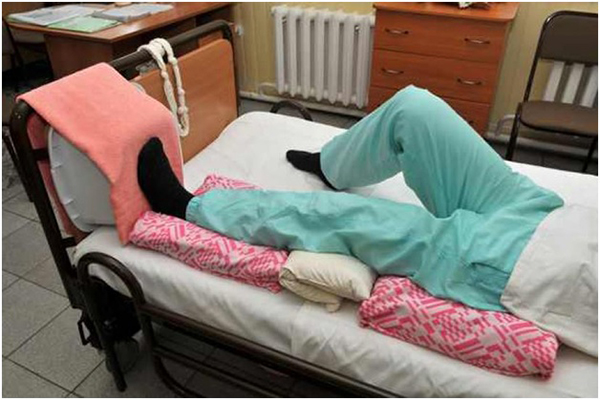 Болит спина при переломе шейки бедра