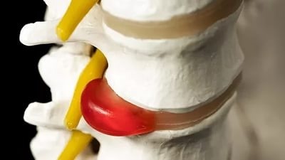 Можно делать массаж болит спина