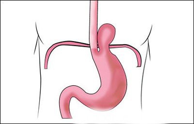 отрыжка воздухом и боль в грудной клетке после еды