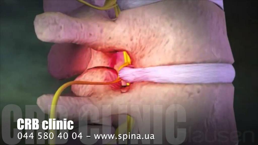 Что делать когда болит спина болит внизу