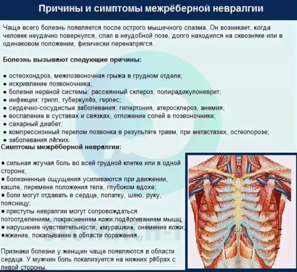 Невралгия спины и болит живот