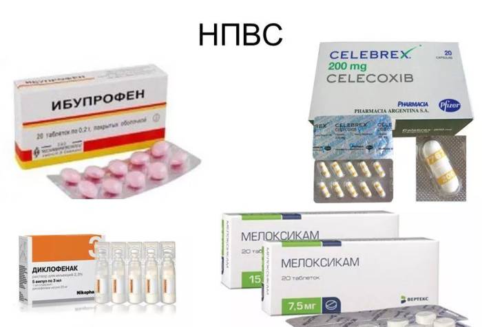 Невралгия спины и болит живот