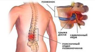 болят колени спина шея