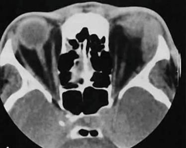 Болит спина в поясничном отделе при наклоне