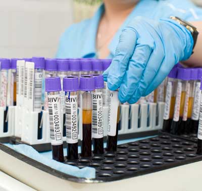 биохимический анализ крови