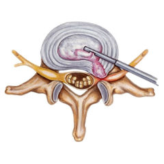 Боль после операции