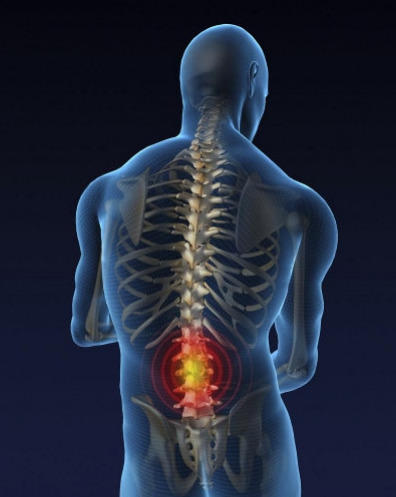 остеохондроз