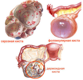 Болит спина у подростка мальчика