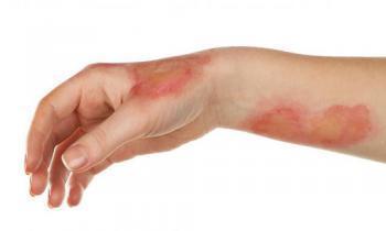 metiluratsil4.jpg Может ли болеть голова от метилурацила