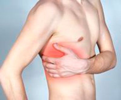 Межрёберная невралгия