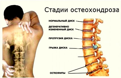 болят колени спина шея