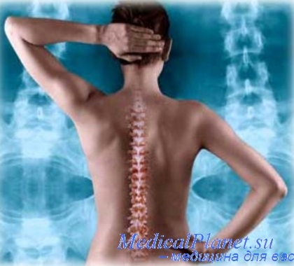 остеохондроз