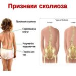 болит спина в области поясницы при беге