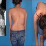 После еды болит за грудиной и в спине