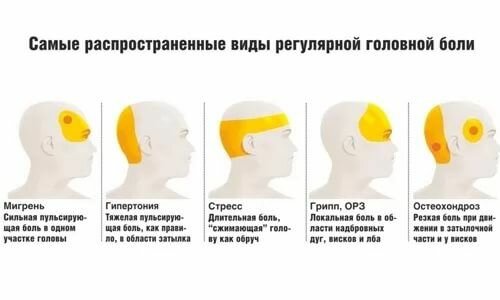 Сопли неделю и болит голова